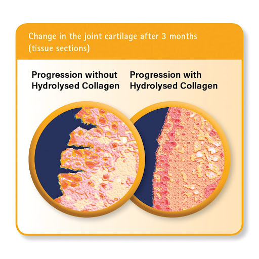 Change in Joint cartilage after 3 months